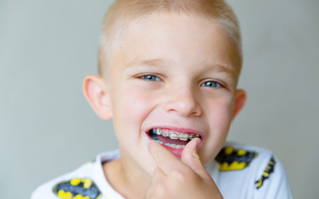 Milyen fiatalon lehet a fogszabályozó kezelést elkezdeni?